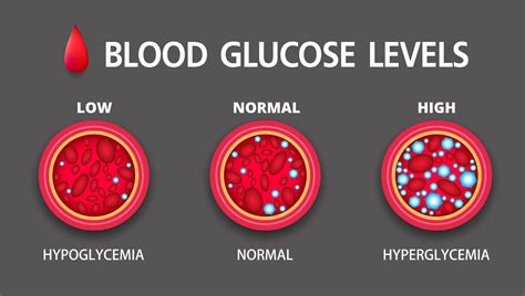 Hyperglycemia vs. Hypoglycemia | Medtronic
