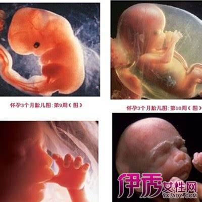 【三个多月胎儿发育情况】【图】三个多月胎儿发育情况介绍 怀孕几个发育阶段准妈妈知多少(3)_伊秀亲子|yxlady.com