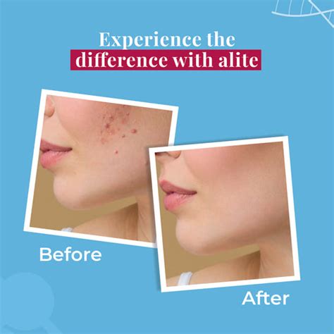 Face Care – Alite Skin care