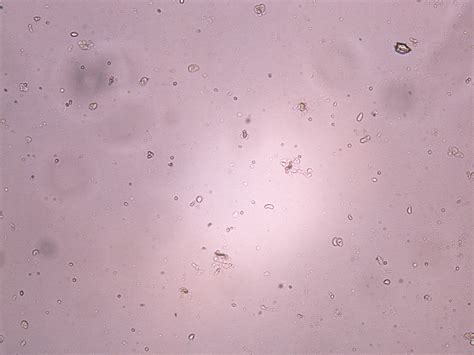 Image result for Small Intestine Epithelial Cells