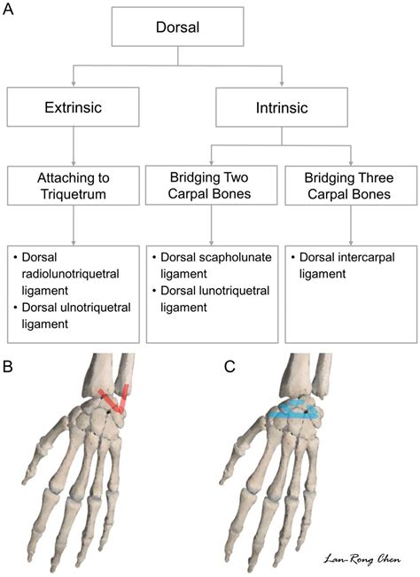 Dorsal Wrist Impingement Symptoms