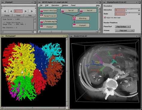 Image result for MeVisLab Connectors Triangle