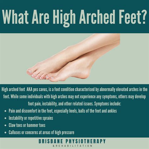 High Arch Feet - Causes, Symptoms & Treatment - Brisbane Physiotherapy ...
