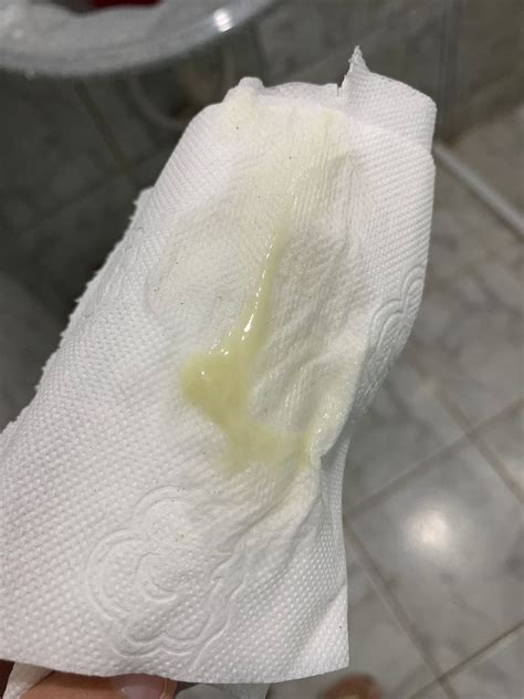 Tampão mucoso? | BabyCenter