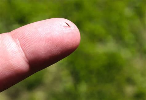 Image result for Getting Splinter Out