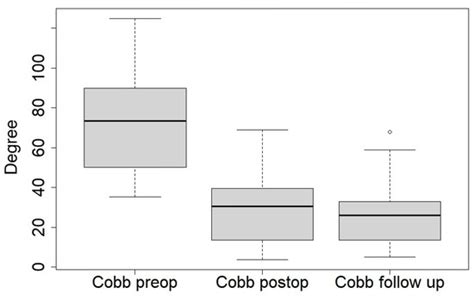 Minimally Invasive Bipolar Technique for Scoliosis in Rett Syndrome ...