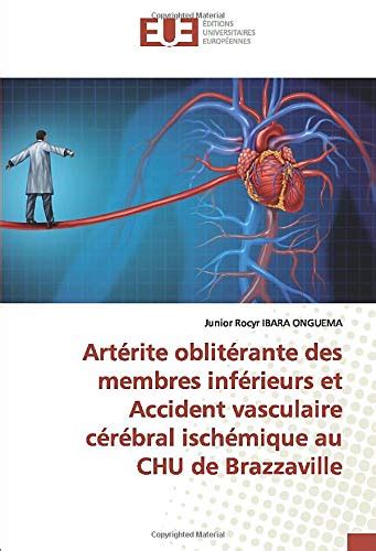 Buy Artérite oblitérante des membres inférieurs et Accident vasculaire ...