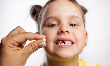 Clear Aligners for Misaligned Teeth