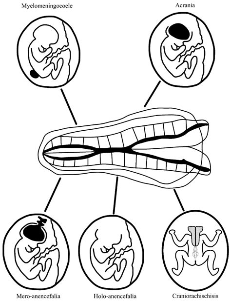 Fetal and Placental Causes of Elevated Serum Alpha-Fetoprotein Levels ...