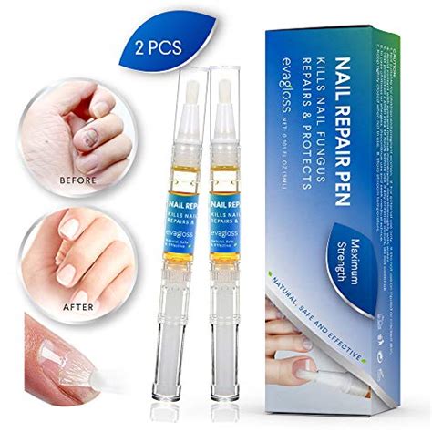 Buy Fungus Stop, Anti-Fungal Nail Pen - Kill Fungus, Remove ...