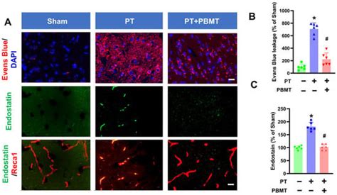 Photobiomodulation Inhibits Ischemia-Induced Brain Endothelial ...