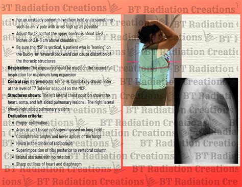 Image result for Chest X-Ray Tutorial