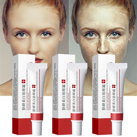 Dark Spot Remover for Face, 3PCS Dark Spot Corrector India | Ubuy