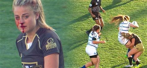 This Rugby War Goddess Continued To Play With A Broken Nose