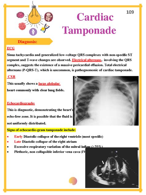 Cardiology-28 - Cardiology - Diagnosis: Cardiac Tamponade ECG Sinus ...