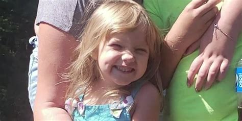 GRAPHIC: Girl who was attacked by dog receives over 1,000 stitches