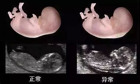 2022年胎儿发育标准对照表图最新版 (附胎儿体重计算公式)_宝宝之家