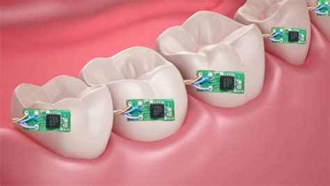 This tiny wireless tooth sensor can be your dietician! - India Today