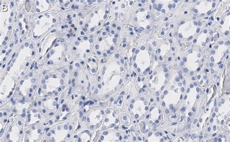 Anti-Bmi-1 Antibody, clone 1G8 ZooMAb® Rabbit Monoclonal recombinant ...