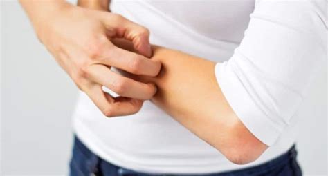 Can you donate blood if you have a skin disease? | TheHealthSite.com