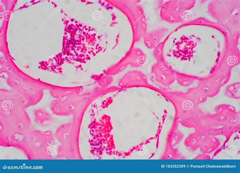 Human Hyaline Cartilage Bone Under Microscope View for Education ...