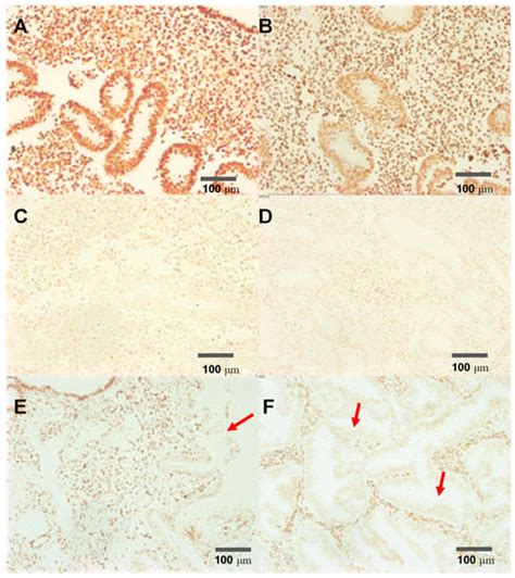 One Step Histological Detection and Staining of the PTEN Tumor ...