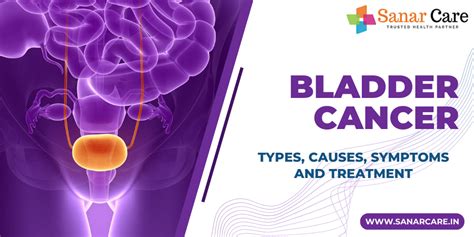 Bladder Cancer - Types, Causes, Symptoms and Treatment
