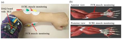 Wearable Physiological Monitoring System Based on Electrocardiography ...