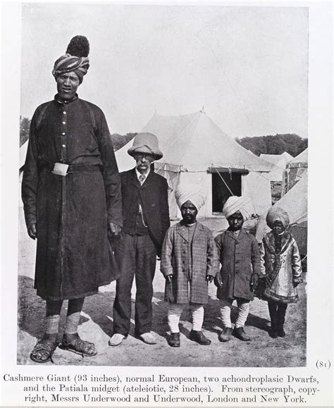 Types of "Indian Dwarfism"- giants and dwarfs, ascending line ...