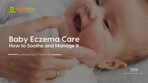 Baby Eczema Care: How to Soothe and Manage It – ShuShu Babies