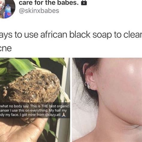 Pin by Burford on Black Skin Care | African skin care, Black skin care, Simple skincare