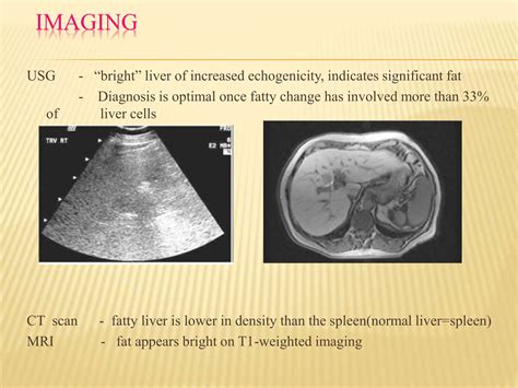NON ALCOHOLIC FATTY LIVER DISEASES modify (edited by Kyin).pptx