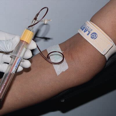 PRF Protocol 的图像结果