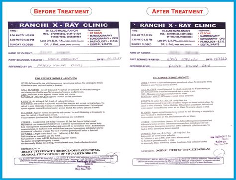 MYOMETRIAL CYST CURE TREATMENT
