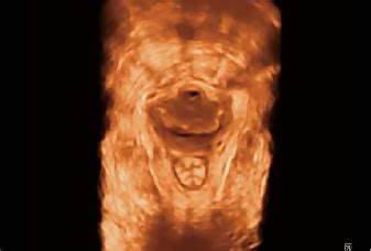 P20 | Value and Significance | Sonoscape India