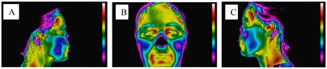 Thermographic Study of the Orofacial Structures Involved in ...