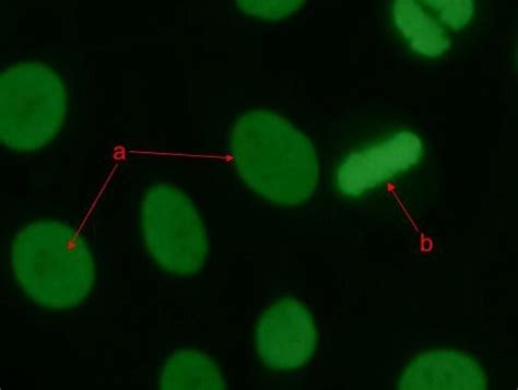 Image result for Homogeneous Pattern