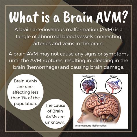 Image result for AVM Brain