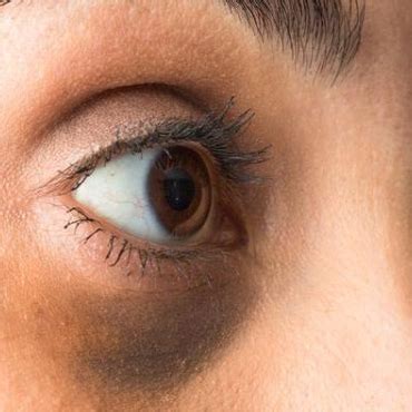 Anti Dark Circle/Anti Dark Spots – Centre For Cruelty free Testing