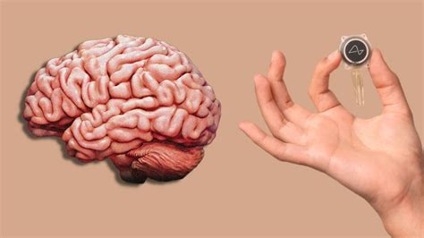 Elon Musk’s Neuralink Gets Green Light For Brain-Implant Trials On ...