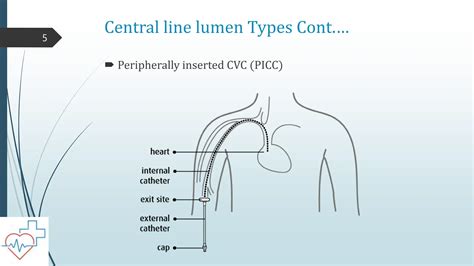 Central venous catheter Introductio.pptx