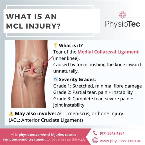 Medial Collateral Ligament Injuries of the Knee: Causes, Symptoms, and Treatment