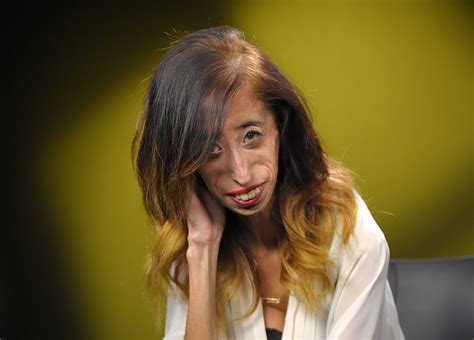 Ugliest Woman Alive Lizzie Velasquez