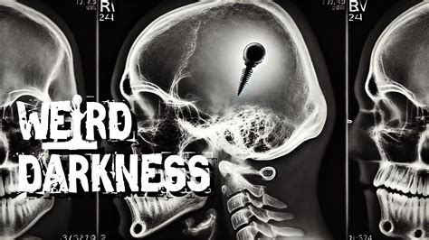 Image result for Alien Implants Just Schrapnel