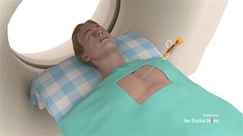 How Painful Is A Needle Biopsy Of The Lung at Thelma Guerrero blog