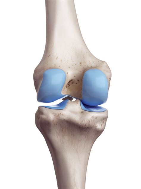 Cartilage damage knee osteoarthritis treatment Vienna - Dr. Martin Gruber