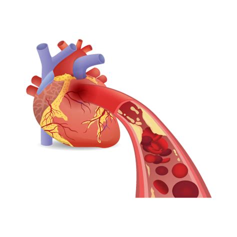 Best Cardiothoracic and Vascular Surgery Hospital in Navi Mumbai