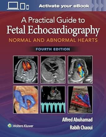 Buy A Practical Guide to Fetal Echocardiography: Normal and Abnormal ...