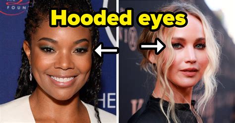 Droopy Eyelid Hooded