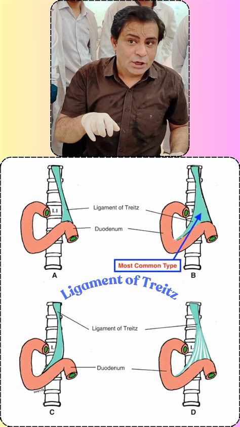 Ligament Of Treitz